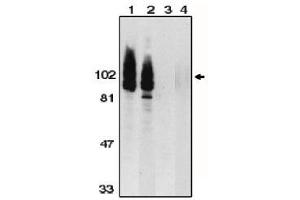 Image no. 1 for anti-ADAM Metallopeptidase Domain 17 (ADAM17) (AA 807-823), (C-Term) antibody (ABIN264994) (ADAM17 抗体  (C-Term))