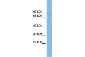 WB Suggested Anti-RAI16 Antibody Titration: 0. (FAM160B2 抗体  (N-Term))