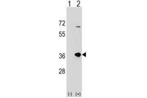 Western blot analysis of SULT1B1 (arrow) using rabbit polyclonal SULT1B1 Antibody (C-term) . (SULT1B1 抗体  (C-Term))