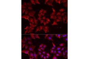 Immunofluorescence analysis of MCF7 cells using PCBD1 Polyclonal Antibody (PCBD1 抗体)