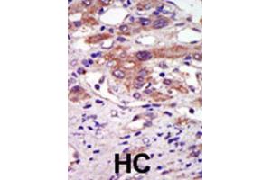 Immunohistochemistry (IHC) image for anti-Ribosomal Protein S6 Kinase, 90kDa, Polypeptide 6 (RPS6KA6) antibody (ABIN3003591) (RPS6KA6 抗体)