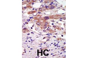 Immunohistochemistry (IHC) image for anti-Ribosomal Protein S6 Kinase, 90kDa, Polypeptide 6 (RPS6KA6) antibody (ABIN5023859) (RPS6KA6 抗体)