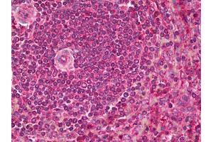 Anti-PCSK9 antibody IHC of human spleen. (PCSK9 抗体)