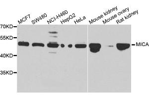 Western blot analysis of extracts of various cell lines, using MICA antibody. (MICA 抗体)