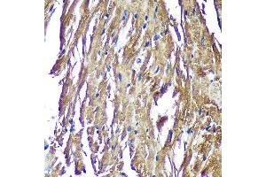 Immunohistochemistry (IHC) image for anti-NADH Dehydrogenase (Ubiquinone) 1 alpha Subcomplex, Assembly Factor 4 (NDUFAF4) (AA 1-170) antibody (ABIN7268807)