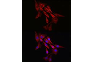 Immunofluorescence analysis of NIH/3T3 cells using α-Tubulin Rabbit mAb (ABIN7271036) at dilution of 1:100 (40x lens). (TUBA4A 抗体)
