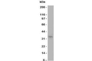Western blot testing of Aquaporin 10 antibody and COLO320 cell lysate (Aquaporin 10 抗体  (C-Term))