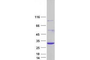 Western Blotting (WB) image for DiGeorge Syndrome Critical Region Gene 6 (DGCR6) protein (Myc-DYKDDDDK Tag) (ABIN2719437)