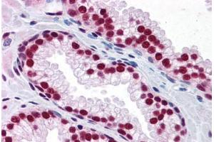 Human Prostate: Formalin-Fixed, Paraffin-Embedded (FFPE) (SAFB 抗体  (AA 111-201))