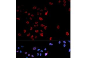 Immunofluorescence analysis of U2OS cells using Phospho-MYC(S62) Polyclonal Antibody (c-MYC 抗体  (pSer62))