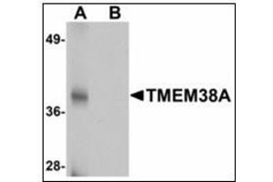 Western blot analysis of TMEM38A in rat skeletal muscle tissue lysate with TMEM38A antibody at 1 µg/ml in (A) the absence and (B) the presence of blocking peptide. (TMEM38A 抗体  (C-Term))