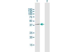 Western Blotting (WB) image for anti-Protein Phosphatase 1, Catalytic Subunit, gamma Isoform (PPP1CC) (AA 1-323) antibody (ABIN948300)