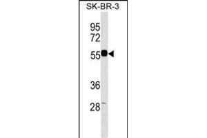 EEPD1 Antibody (C-term) (ABIN1537333 and ABIN2849670) western blot analysis in SK-BR-3 cell line lysates (35 μg/lane). (EEPD1 抗体  (C-Term))