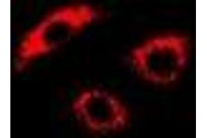 Immunofluorescent analysis of PDK4 staining in U2OS cells. (PDK4 抗体)