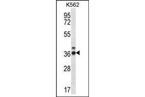 Western blot analysis of RPP38 Antibody (C-term) Cat. (RPP38 抗体  (C-Term))