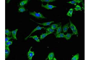 Immunofluorescent analysis of Hela cells using ABIN7175921 at dilution of 1:100 and Alexa Fluor 488-congugated AffiniPure Goat Anti-Rabbit IgG(H+L) (XAF1 抗体  (AA 172-259))