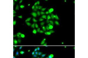 Immunofluorescence analysis of U2OS cells using UBE2G1 Polyclonal Antibody (UBE2G1 抗体)