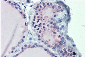 Thyroid, Human: Formalin-Fixed, Paraffin-Embedded (FFPE) (GNAS 抗体  (AA 36-85))