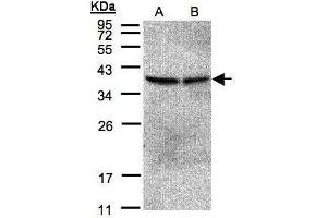 WB Image Sample(30 μg of whole cell lysate) A:293T B:A431, 12% SDS PAGE antibody diluted at 1:500 (PPP2CB 抗体  (Center))