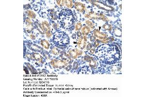 Human kidney (P2RX7 抗体  (N-Term))