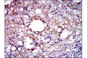Immunohistochemistry (IHC) image for anti-Integrin beta 1 (ITGB1) antibody (ABIN1844058) (ITGB1 抗体)