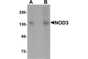 Western blot analysis of NOD3 in 3T3 cell lysate with NOD3 antibody at (A) 1 and (B) 2 μg/ml. (NLRC3 抗体  (Center))