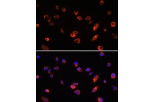 Immunofluorescence analysis of L929 cells using B antibody (ABIN6130859, ABIN6137109, ABIN6137110 and ABIN6220869) at dilution of 1:100. (ARL13B 抗体  (AA 1-240))