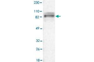 Western Blot analysis of RT-4 cell lysate with ARHGEF6 polyclonal antibody . (ARHGEF6 抗体)