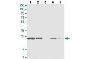 Western blot analysis of Lane 1: RT-4, Lane 2: U-251 MG, Lane 3: Human Plasma, Lane 4: Liver, Lane 5: Tonsil with C1orf52 polyclonal antibody  at 1:250-1:500 dilution. (C1ORF52 抗体)