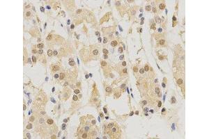 Immunohistochemistry of paraffin-embedded Human stomach using PSMB5 Polyclonal Antibody at dilution of 1:200 (40x lens). (PSMB5 抗体)