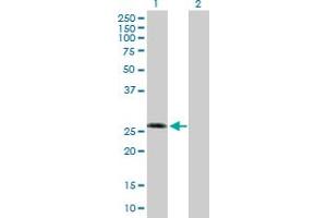 Western Blot analysis of KCNIP3 expression in transfected 293T cell line by KCNIP3 MaxPab polyclonal antibody. (DREAM 抗体  (AA 1-256))