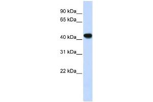 ADH1B antibody used at 1 ug/ml to detect target protein. (ADH1B 抗体)