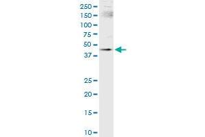 Immunoprecipitation (IP) image for anti-SWI/SNF Related, Matrix Associated, Actin Dependent Regulator of Chromatin, Subfamily B, Member 1 (SMARCB1) (AA 1-385) antibody (ABIN520282)