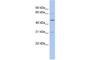 WB Suggested Anti-ZNF641 Antibody Titration:  0. (ZNF641 抗体  (Middle Region))