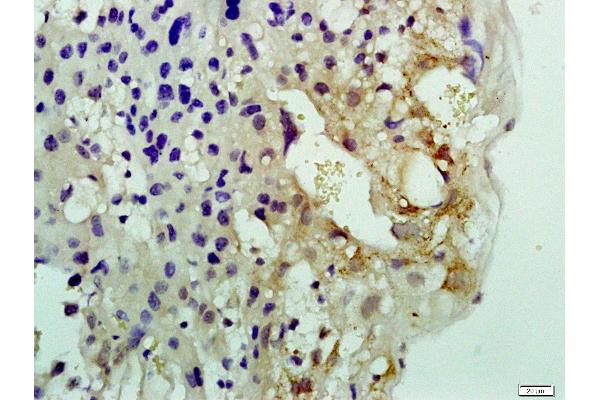 Nucleolar Protein 1 (NOL1) 抗体