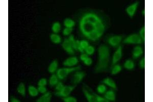 Detection of CXADR in Human Hela Cell using Polyclonal Antibody to Coxsackie Virus And Adenovirus Receptor (CXADR) (Coxsackie Adenovirus Receptor 抗体  (AA 20-229))