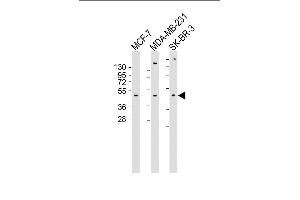 All lanes : Anti-ADRA2B Antibody (Center) at 1:1000 dilution Lane 1: MCF-7 whole cell lysate Lane 2: MDA-MB-231 whole cell lysate Lane 3: SK-BR-3 whole cell lysate Lysates/proteins at 20 μg per lane. (ADRA2B 抗体  (AA 343-369))
