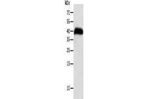 Gel: 10 % SDS-PAGE, Lysate: 40 μg, Lane: Human thigh malignant fibrous histiocytoma tissue, Primary antibody: ABIN7131272(SYT5 Antibody) at dilution 1/100, Secondary antibody: Goat anti rabbit IgG at 1/8000 dilution, Exposure time: 8 hours (Synaptotagmin V 抗体)
