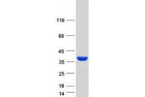 Validation with Western Blot