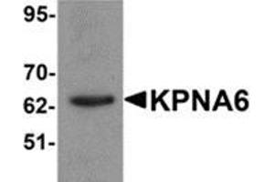 Western blot analysis of KPNA6 in 293 cell lysate with KPNA6 antibody at 1 μg/ml. (KPNA6 抗体  (N-Term))