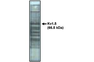 Western Blotting (WB) image for anti-Potassium Voltage-Gated Channel, Shaker-Related Subfamily, Member 5 (KCNA5) antibody (ABIN306873)