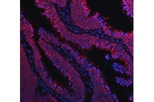 IF analysis of TIP49A/RUVBL1 using anti-TIP49A/RUVBL1 antibody (ABIN7599928). (RUVBL1 抗体  (AA 13-23))