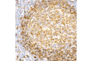 Immunohistochemistry of paraffin-embedded Human tonsil using CD79a antibody (ABIN7265805) at dilution of 1:100 (40x lens). (CD79a 抗体)