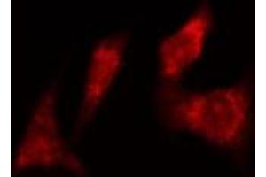 ABIN6277985 staining  Hela cells by IF/ICC. (CDC6 抗体)