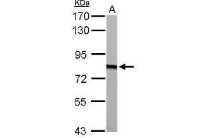 WB Image HADHA antibody detects HADHA protein by Western blot analysis. (HADHA 抗体  (C-Term))