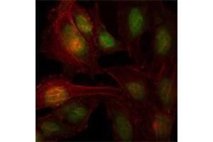 Immunofluorescence analysis of Hela cells using ZBTB7B antibody (green). (ZBTB7B 抗体)