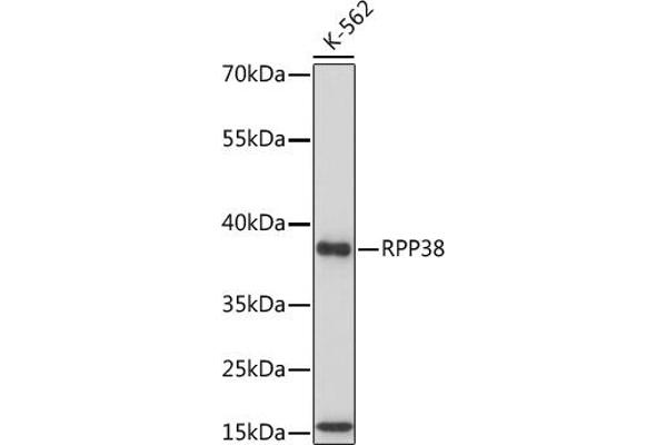 RPP38 抗体  (AA 20-110)