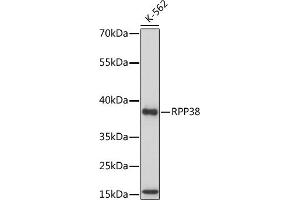 Western blot analysis of extracts of various cell lines, using RPP38 antibody (ABIN7269983) at 1:1000 dilution. (RPP38 抗体  (AA 20-110))