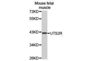 Western Blotting (WB) image for anti-Urotensin 2 Receptor (UTS2R) antibody (ABIN1875304) (UTS2R 抗体)