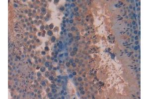DAB staining on IHC-P; Samples: Mouse Testis Tissue (Pituitary Adenylate Cyclase Activating Peptide (AA 1-175) 抗体)